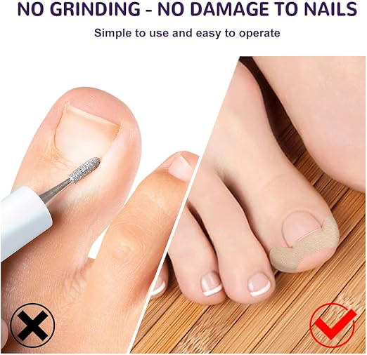 Ayak Tırnağı Düzeltme Bandı 50 Adet